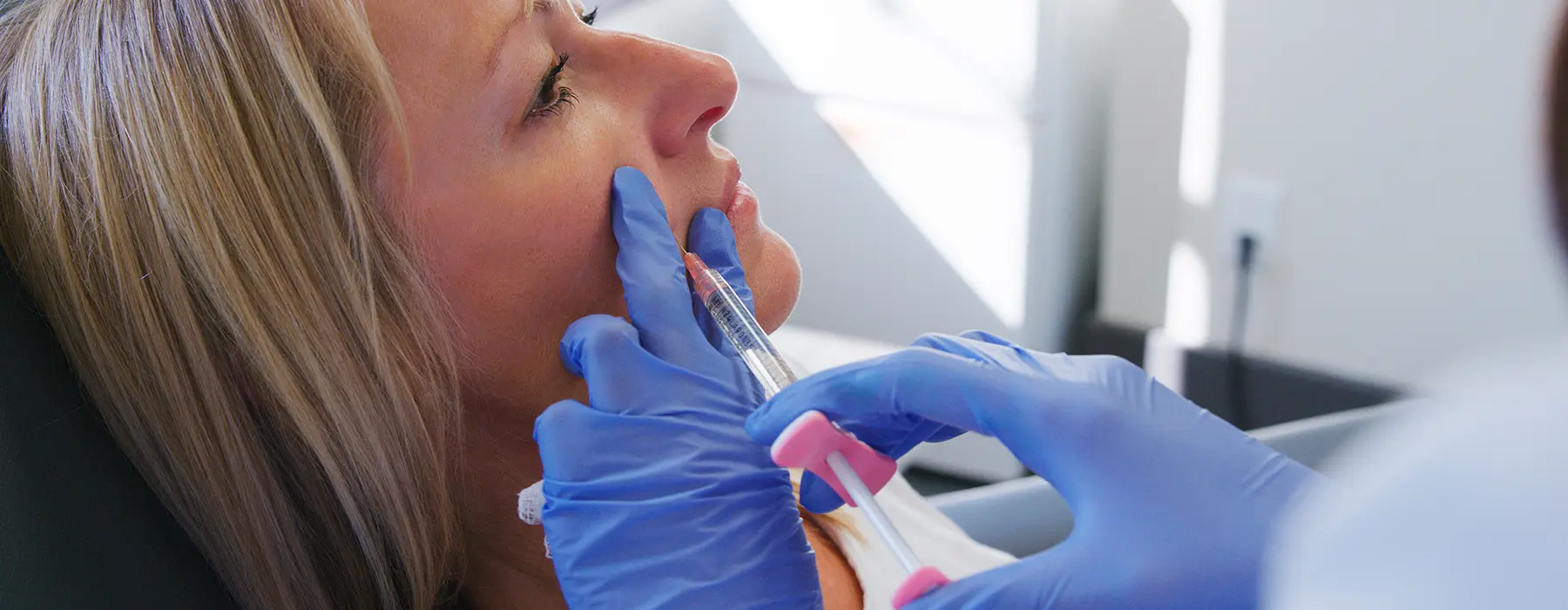Achieve Natural-Looking Volume with Cheek, Temple, and Lip Fillers