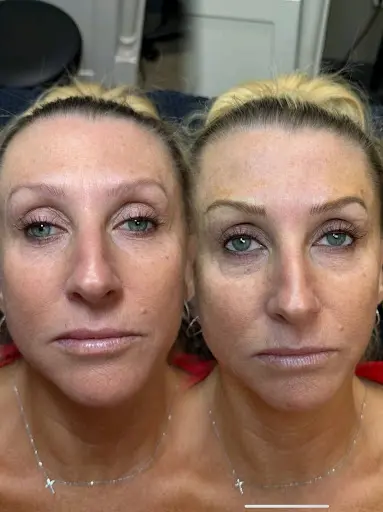 Nano brows before and after Nano brows before and after