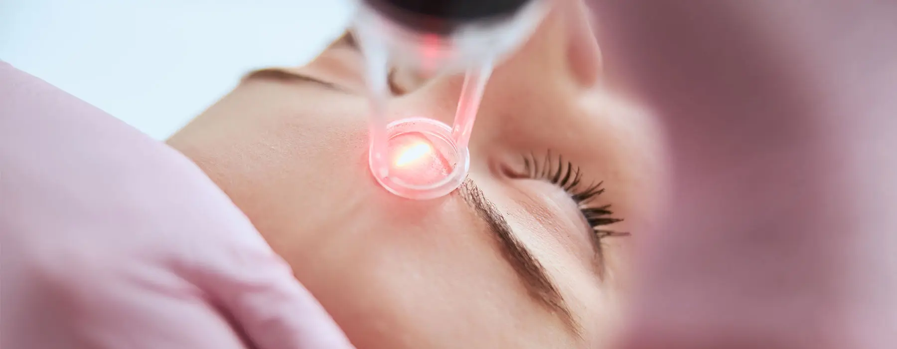 Erbium Laser vs. CO2 Laser: Which Treatment Is Right for Your Skin?