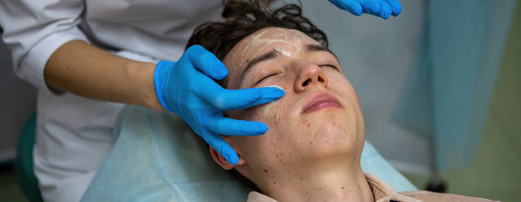 Top 5 Aesthetic Treatments For Teens With Acne-Prone Skin